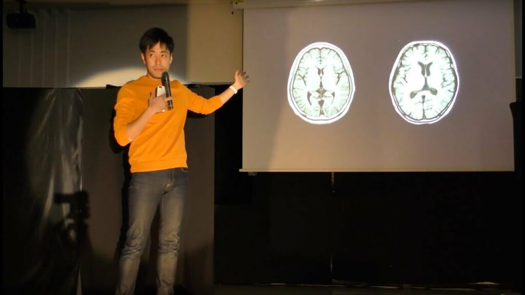 Technology Meets Neuroscience テクノロジーと神経科学の融合 | Junichi Ushiba | TEDxKeioHighSchool