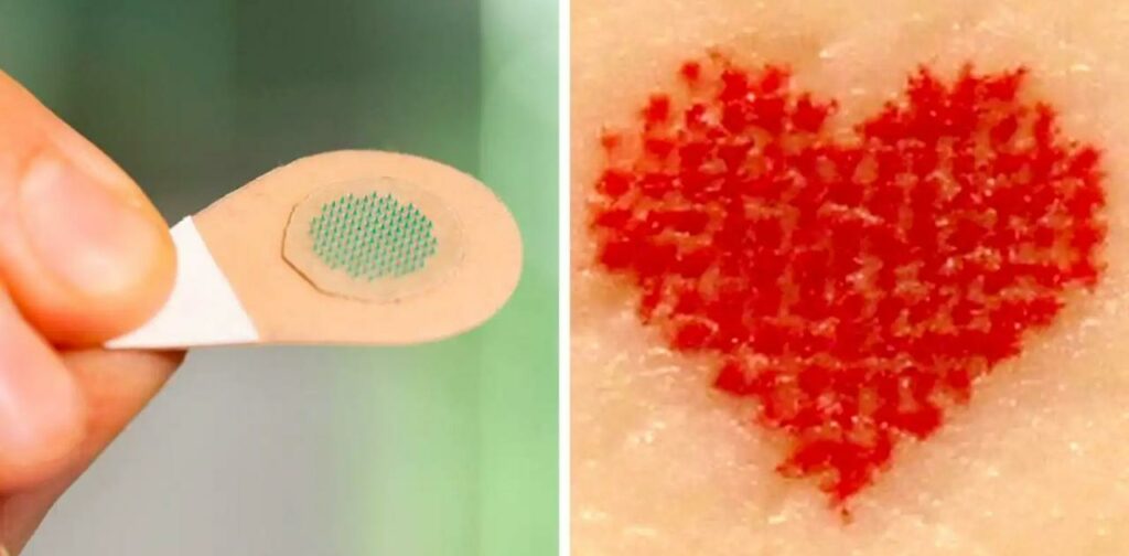 インクでできたマイクロニードルで痛くないタトゥーが実現するかも